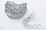 3D-печать в стоматологии