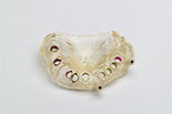 3D-печать в стоматологии